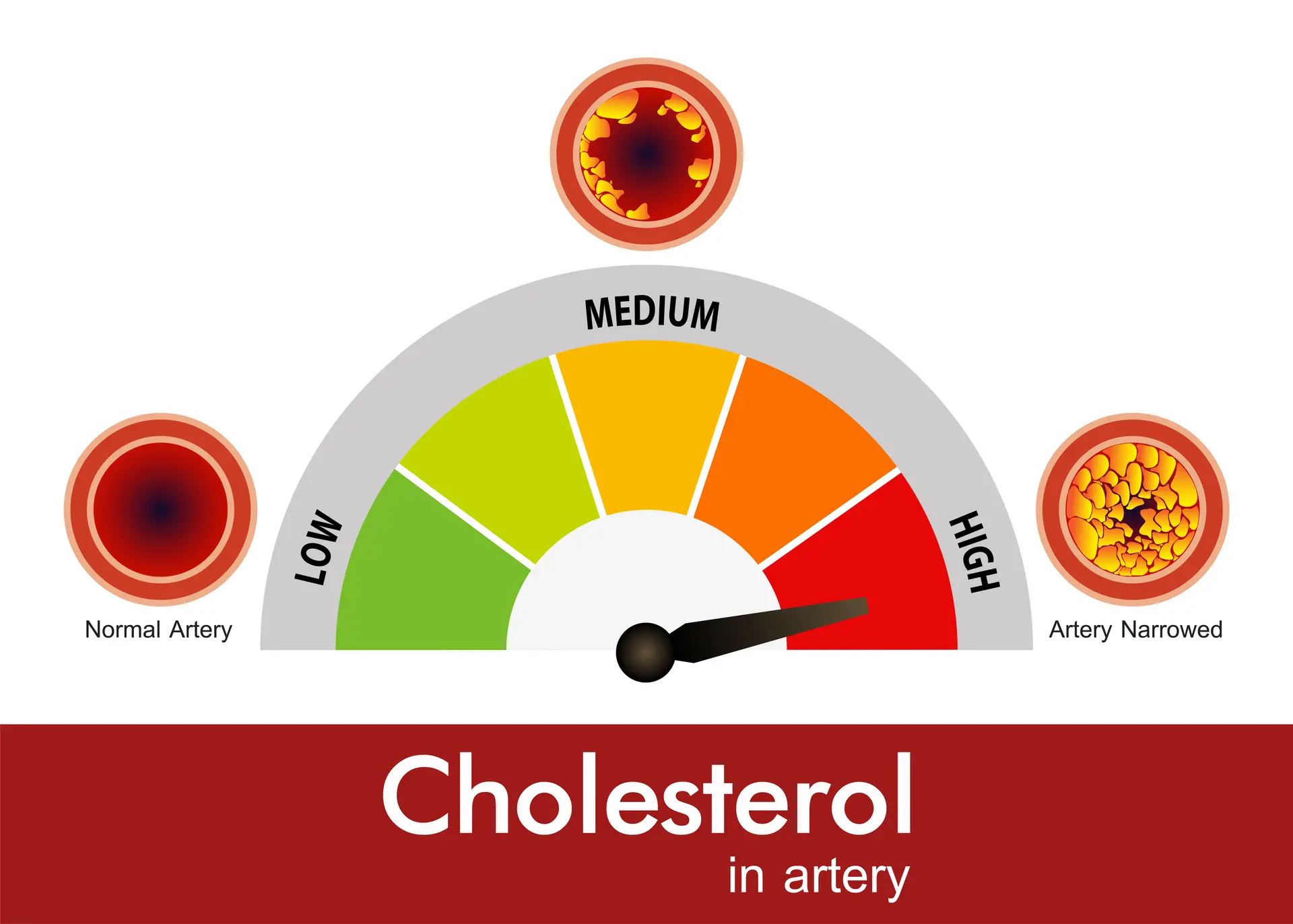 fi news risks high cholesterol men and how get it under control